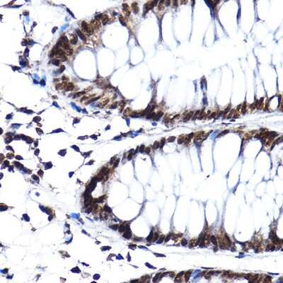 Immunohistochemistry-Paraffin: SF3A3 Antibody [NBP2-94076] - Immunohistochemistry of paraffin-embedded human colon using SF3A3 Rabbit pAb (NBP2-94076) at dilution of 1:100 (40x lens). Perform high pressure antigen retrieval with 10 mM citrate buffer pH 6.0 before commencing with IHC staining protocol.