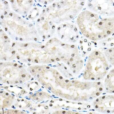 Immunohistochemistry-Paraffin: SF3A3 Antibody [NBP2-94076] - Immunohistochemistry of paraffin-embedded mouse kidney using SF3A3 Rabbit pAb (NBP2-94076) at dilution of 1:100 (40x lens). Perform high pressure antigen retrieval with 10 mM citrate buffer pH 6.0 before commencing with IHC staining protocol.