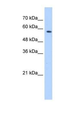 Western Blot: SF3A3 Antibody [NBP1-57424] - 721_B cell lysate, concentration 0.2-1 ug/ml.