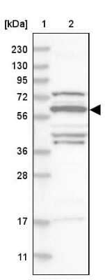 Western Blot: SF3A3 Antibody [NBP1-87212] - Lane 1: Marker  [kDa] 230, 130, 95, 72, 56, 36, 28, 17, 11.  Lane 2: Human cell line RT-518