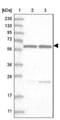 Western Blot: SF3A3 Antibody [NBP2-38200] - Lane 1: Marker  [kDa] 230, 130, 95, 72, 56, 36, 28, 17, 11.  Lane 2: Human cell line RT-4.  Lane 3: Human cell line U-251MG