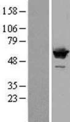 Western Blot: SF3A3 Overexpression Lysate (Adult Normal) [NBL1-15875] Left-Empty vector transfected control cell lysate (HEK293 cell lysate); Right -Over-expression Lysate for SF3A3.