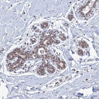 <b>Orthogonal Strategies Validation. </b>Immunohistochemistry-Paraffin: SF3B14 Antibody [NBP1-87430] - Staining of human breast shows moderate nuclear positivity in glandular cells.