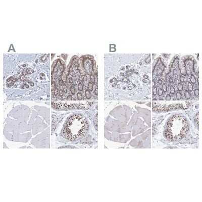 <b>Independent Antibodies Validation. </b>Immunohistochemistry-Paraffin: SF3B14 Antibody [NBP1-87430] - Staining of human breast, colon, skeletal muscle and testis using Anti-SF3B6 antibody NBP1-87430 (A) shows similar protein distribution across tissues to independent antibody NBP1-87431 (B).