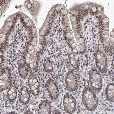 Immunohistochemistry-Paraffin: SF3B14 Antibody [NBP1-87430] - Staining of human colon shows moderate nuclear positivity in glandular cells.