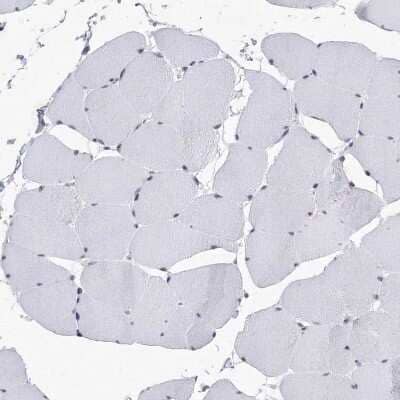 Immunohistochemistry-Paraffin: SF3B14 Antibody [NBP1-87430] - Staining of human skeletal muscle shows no positivity in myocytes as expected.