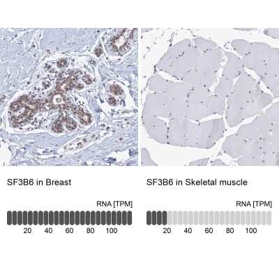 Immunohistochemistry-Paraffin: SF3B14 Antibody [NBP1-87430] - Staining in human breast and skeletal muscle tissues using NBP1-87430 antibody. Corresponding SF3B6 RNA-seq data are presented for the same tissues.