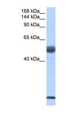 Western Blot: SF3B14 Antibody [NBP1-57227] - Human Placenta lysate, concentration 0.2-1 ug/ml.