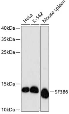 Western Blot: SF3B14 Antibody [NBP2-94304] - Analysis of extracts of various cell lines, using SF3B14 at 1:3000 dilution. Secondary antibody: HRP Goat Anti-Rabbit IgG (H+L) at 1:10000 dilution. Lysates/proteins: 25ug per lane. Blocking buffer: 3% nonfat dry milk in TBST. Detection: ECL Basic Kit . Exposure time: 90s.