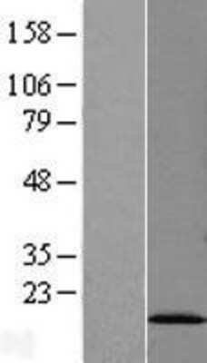 Western Blot: SF3B14 Overexpression Lysate (Adult Normal) [NBL1-15876] Left-Empty vector transfected control cell lysate (HEK293 cell lysate); Right -Over-expression Lysate for SF3B14.