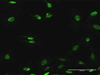 Immunocytochemistry/Immunofluorescence: SF3B2 Antibody [H00010992-B02P] - Analysis of purified antibody to SF3B2 on HeLa cell. (antibody concentration 10 ug/ml)