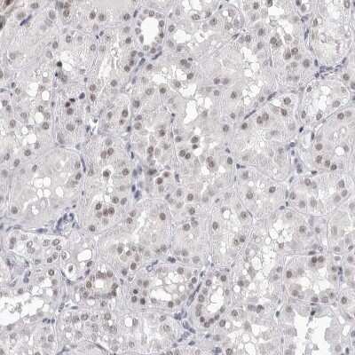 Immunohistochemistry-Paraffin: SF3B4 Antibody [NBP1-83191] - Staining of human kidney shows moderate nuclear positivity in cells in tubules.