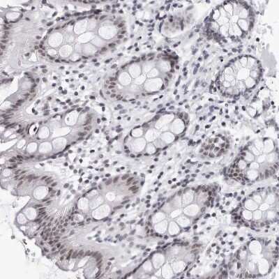 Immunohistochemistry-Paraffin: SF3B4 Antibody [NBP1-83191] - Staining of human rectum shows moderate nuclear positivity in glandular cells.