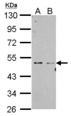 Western Blot: SF3B4 Antibody [NBP2-20327] - Sample (30 ug of whole cell lysate) A: NIH-3T3 B: JC 10% SDS PAGE gel, diluted at 1:1000.