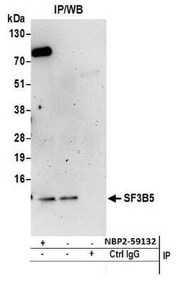 Immunoprecipitation: SF3B5 Antibody [NBP2-59132] - Detection of immunoprecipitates. Samples: Whole cell lysate (0.5 or 1.0 mg per IP reaction; 20% of IP loaded) from 293T cells prepared using NETN lysis buffer. Antibodies: Affinity purified rabbit anti-SF3B5 antibody NBP2-59132 used for IP at 20 ul per reaction. Chemiluminescence with an exposure time of 3 minutes.