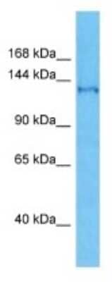 Western Blot: SFI1 Antibody [NBP3-09931] - Western blot analysis of SFI1 in Jurkat Whole Cell lysates. Antibody dilution at 1.0ug/ml