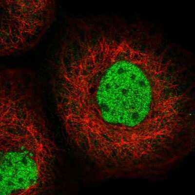 Immunocytochemistry/Immunofluorescence: SFMBT1 Antibody [NBP2-48652] - Immunofluorescent staining of human cell line A-431 shows localization to nucleoplasm.