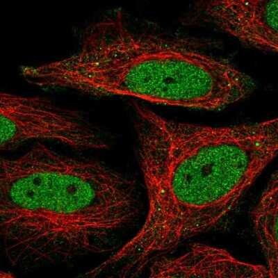 Immunocytochemistry/Immunofluorescence: SFMBT1 Antibody [NBP2-56939] - Staining of human cell line SiHa shows localization to nucleoplasm.