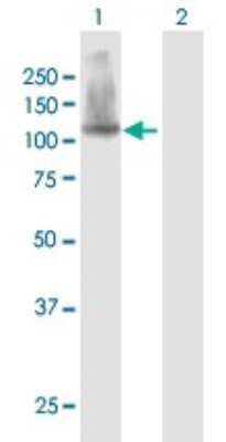 Western Blot: SFMBT1 Antibody [H00051460-B01P] - Analysis of SFMBT1 expression in transfected 293T cell line by SFMBT1 polyclonal antibody.  Lane 1: SFMBT1 transfected lysate(95.26 KDa). Lane 2: Non-transfected lysate.