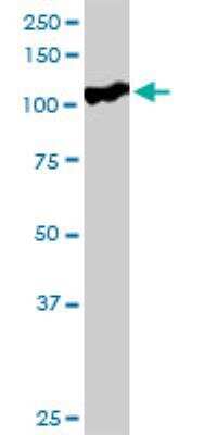 Western Blot: SFMBT1 Antibody [H00051460-D01P] - SFMBT1 MaxPab rabbit polyclonal antibody. Western Blot analysis of SFMBT1 expression in human colon.
