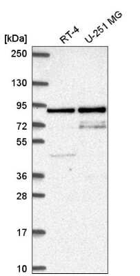 Western Blot: SFMBT1 Antibody [NBP2-56939] - Analysis in human cell line RT-4 and human cell line U-251 MG.