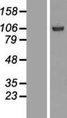 Western Blot: SFMBT1 Overexpression Lysate (Adult Normal) [NBL1-15881] Left-Empty vector transfected control cell lysate (HEK293 cell lysate); Right -Over-expression Lysate for SFMBT1.