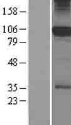 Western Blot: SFMBT1 Overexpression Lysate (Adult Normal) [NBP2-09093] Left-Empty vector transfected control cell lysate (HEK293 cell lysate); Right -Over-expression Lysate for SFMBT1.