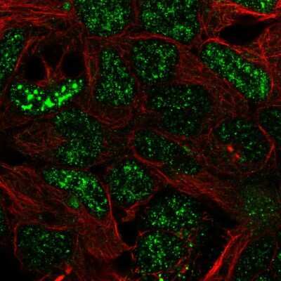 Immunocytochemistry/ Immunofluorescence SFMBT2 Antibody