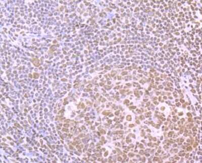 Immunohistochemistry-Paraffin: SFPQ Antibody (JU33-99) [NBP2-75664] - Analysis of paraffin-embedded human tonsil tissue using anti-SFPQ antibody. Counter stained with hematoxylin.
