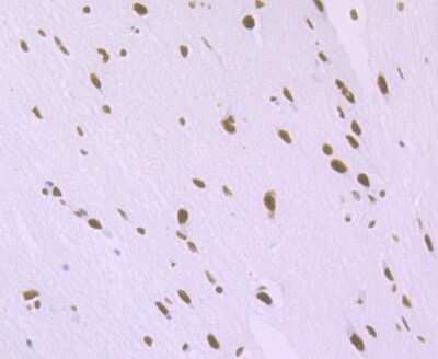 Immunohistochemistry-Paraffin: SFPQ Antibody (JU33-99) [NBP2-75664] - Analysis of paraffin-embedded rat brain tissue using anti-SFPQ antibody. Counter stained with hematoxylin.
