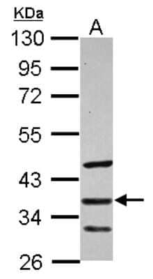 Western Blot: sFRP-5 Antibody [NBP2-20331] - Sample (30 ug of whole cell lysate) A: HeLa 10% SDS PAGE gel, diluted at 1:500.