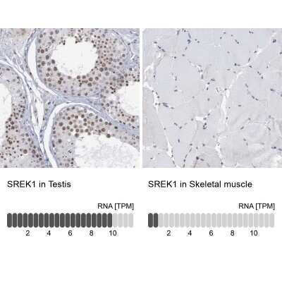 Immunohistochemistry-Paraffin SFRS12 Antibody - BSA Free