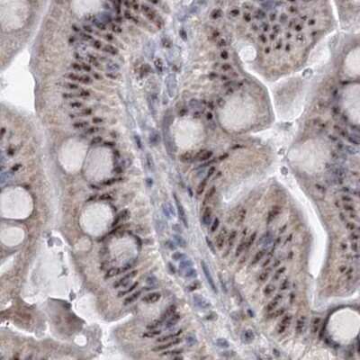 Immunohistochemistry-Paraffin: SFRS12 Antibody [NBP1-87993] - Staining of human small intestine.