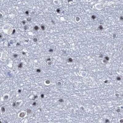 Immunohistochemistry-Paraffin: SFRS12 Antibody [NBP1-87993] - Staining of human cerebral cortex.
