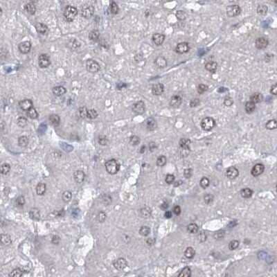 Immunohistochemistry-Paraffin: SFRS12 Antibody [NBP1-87993] - Staining of human liver.