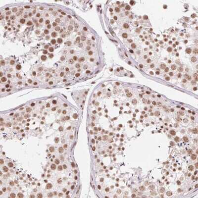 Immunohistochemistry-Paraffin SFRS12 Antibody - BSA Free