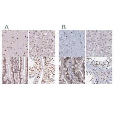 Immunohistochemistry-Paraffin SFRS12 Antibody - BSA Free