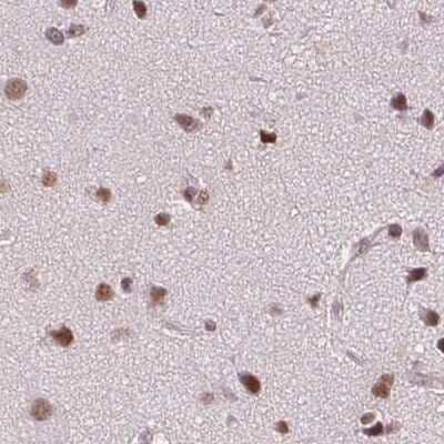 Immunohistochemistry-Paraffin SFRS12 Antibody - BSA Free