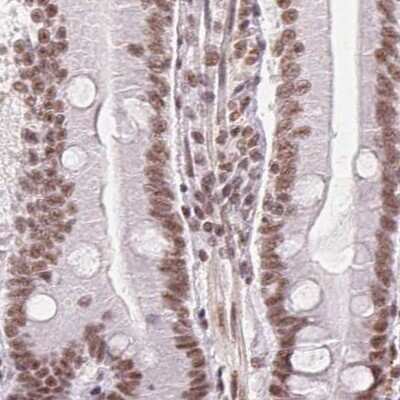 Immunohistochemistry-Paraffin SFRS12 Antibody - BSA Free