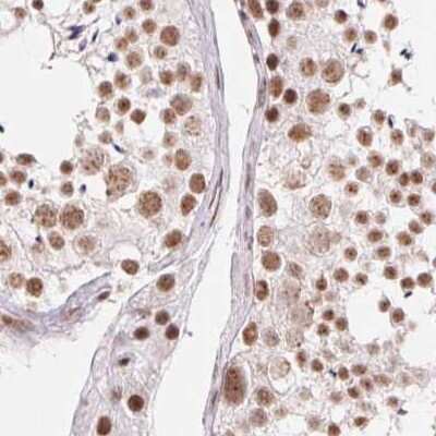 Immunohistochemistry-Paraffin SFRS12 Antibody - BSA Free