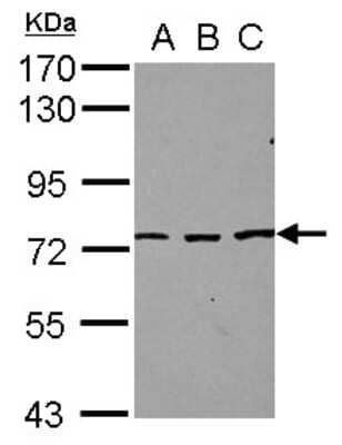Western Blot: SFRS12 Antibody [NBP2-20332] - Sample (30 ug of whole cell lysate) A: NT2D1 B: IMR32 C: U87-MG 7. 5% SDS PAGE gel, diluted at 1:1000.