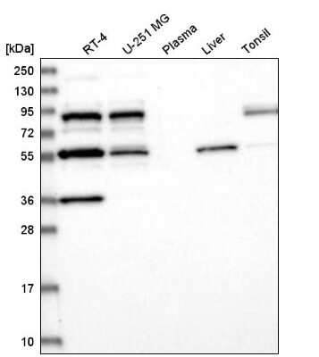Western Blot: SFRS12 Antibody [NBP2-55143] - Analysis in human cell line RT-4, human cell line U-251 MG, human plasma, human liver tissue and human tonsil tissue.