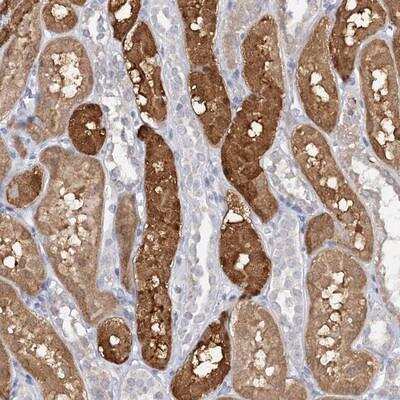 Immunohistochemistry-Paraffin SFRS18 Antibody - BSA Free