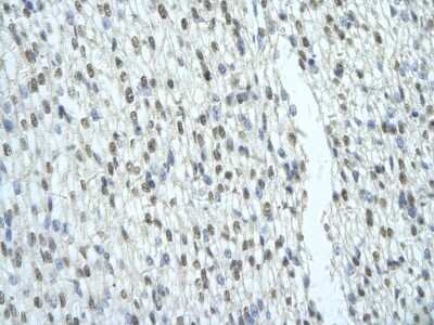 Immunohistochemistry: SFRS2B Antibody [NBP1-57168] - Human Heart cell Cellular data: cardiac cell of renal tubule Antibody Concentration: 4.0-8.0 ug/ml Magnification: 400X.