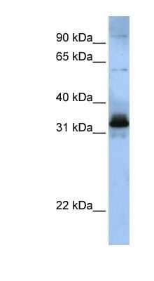 Western Blot: SFRS2B Antibody [NBP1-57168] - Titration: 0.2-1 ug/ml, Positive Control: 721_B cell lysate.