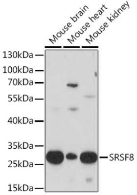 Western Blot: SFRS2B Antibody [NBP3-15521] - Western blot analysis of extracts of various cell lines, using SFRS2B Rabbit pAb (NBP3-15521) at 1:1000 dilution. Secondary antibody: HRP Goat Anti-Rabbit IgG (H+L) at 1:10000 dilution. Lysates/proteins: 25ug per lane. Blocking buffer: 3% nonfat dry milk in TBST. Detection: ECL Basic Kit. Exposure time: 10s.