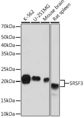 Western Blot: SFRS3 Antibody (9A1Z4) [NBP3-16741] - Western blot analysis of extracts of various cell lines, using SFRS3 Rabbit mAb (NBP3-16741) at 1:1000 dilution. Secondary antibody: HRP Goat Anti-Rabbit IgG (H+L) at 1:10000 dilution. Lysates/proteins: 25ug per lane. Blocking buffer: 3% nonfat dry milk in TBST. Detection: ECL Basic Kit. Exposure time: 10s.