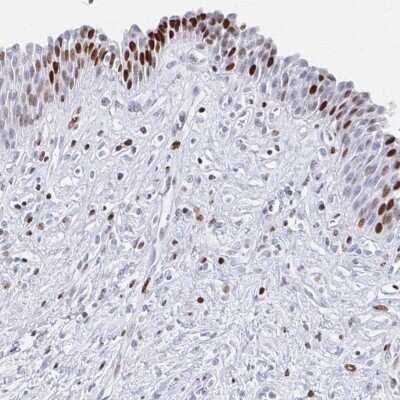 Immunohistochemistry-Paraffin: SFRS3 Antibody [NBP2-38815] - Staining of human urinary bladder shows strong nuclear positivity in urothelial cells.