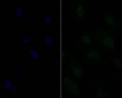 Immunocytochemistry/Immunofluorescence: SFRS3 Antibody (JE46-44) [NBP2-76892] - Immunocytochemistry staining SFRS3 in MG-63 cells (green). Formalin fixed cells were permeabilized with 0.1% Triton X-100 in TBS for 10 minutes at room temperature and blocked with 1% Blocker BSA for 15 minutes at room temperature. Cells were probed with Ki67 polyclonal antibody at a dilution of 1:100 for 1 hour at room temperature, washed with PBS. Alexa Fluorc 488 Goat anti-Rabbit IgG was used as the secondary antibody at 1/100 dilution. The nuclear counter stain is DAPI (blue).