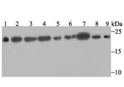 Western Blot: SFRS3 Antibody (JE46-44) [NBP2-76892] - Western blot analysis of SFRS3 on different lysates. Proteins were transferred to a PVDF membrane and blocked with 5% BSA in PBS for 1 hour at room temperature. The primary antibody was used at a 1:500 dilution in 5% BSA at room temperature for 2 hours. Goat Anti-Rabbit IgG - HRP Secondary Antibody at 1:5,000 dilution was used for 1 hour at room temperature.Positive control:Lane 1: Mouse testis tissue lysateLane 2: Rat brain tissue lysateLane 3: A431 cell lysateLane 4: SH-SY-5Y cell lysateLane 5: SiHa cell lysateLane 6: 293 cell lysateLane 7: Hela cell lysateLane 8: HepG2 cell lysateLane 9: A549 cell lysate